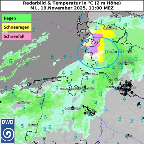 Radarbild und Temperatur in 2 m Höhe am 19.11.2025, 11 Uhr. (Quelle:DWD)